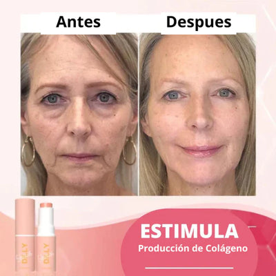 Bálsamo Derol con Ácido Hialurónico. Componente Natural con Múltiples Benefícios