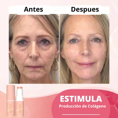 Bálsamo Derol con Ácido Hialurónico. Componente Natural con Múltiples Benefícios